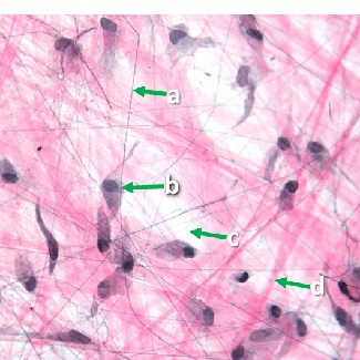 Thumbnail image of connective tissue, click to follow link and learn more about this tissue type