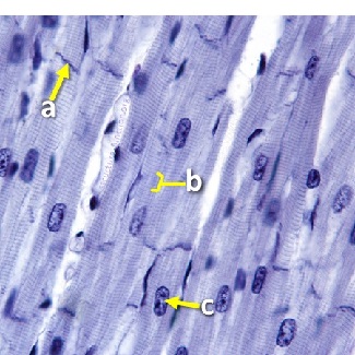 Thumbnail image of muscle tissue, click to follow link and learn more about this tissue type