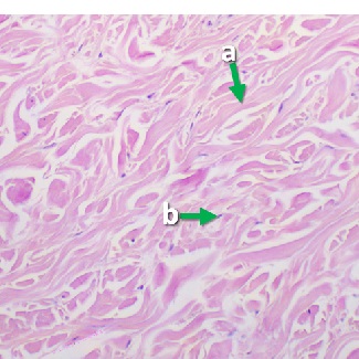 Thumbnail image of connective tissue, click to follow link and learn more about this tissue type