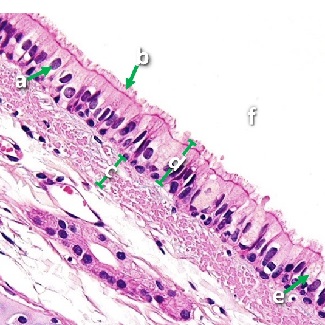 Thumbnail image of an epithelial tissue, click to follow link and learn more about this tissue type