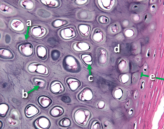 Picture of a tissue sample with arrows pointing scattered structures (a) with cells (b) residing in them where they produce the heterogenous-looking matrix (c) with numerous dark-purple stained strands of fiber (e).