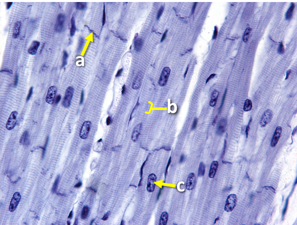 Picture of a tissue sample with striated cells with one nucleus per cell and that have alternating dark and light bands