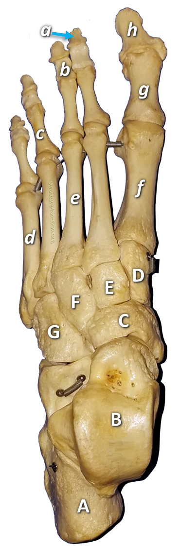 Picture of an articulated foot skeleton with arrows pointing to various features