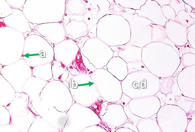 Picture of a tissue sample with arrows pointing to a ring of structures surrounding an open space indicated by the letter 'a'