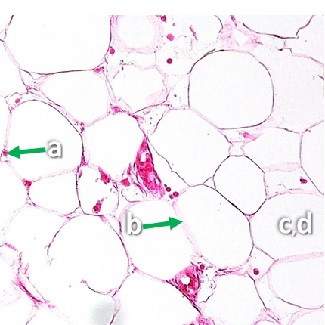 Thumbnail image of connective tissue, click to follow link and learn more about this tissue type