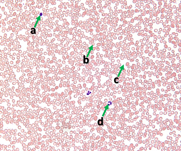 Picture of a tissue sample with arrows pointing to various cells, the most numerous of which are 7 micromenters in diameter and lack nuclei. A few scattered cells have dark-staining nuclei. All reside in the clear/watery matrix (c)