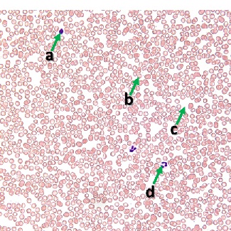 Thumbnail image of connective tissue, click to follow link and learn more about this tissue type