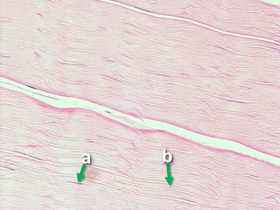 Picture of a tissue sample with arrows pointing to a ring of structures surrounding an open space indicated by the letter 'a'