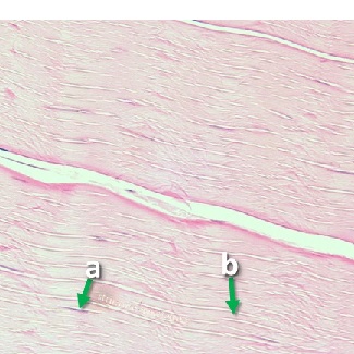 Thumbnail image of connective tissue, click to follow link and learn more about this tissue type