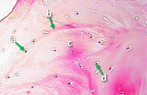 Picture of a tissue sample with arrows pointing to a ring of structures surrounding an open space indicated by the letter 'a'