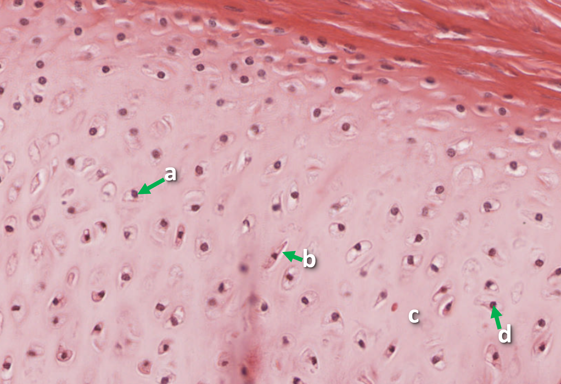 Picture of a tissue sample with arrows pointing to a ring of structures surrounding an open space indicated by the letter 'a'