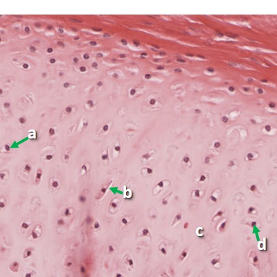 Thumbnail image of connective tissue, click to follow link and learn more about this tissue type