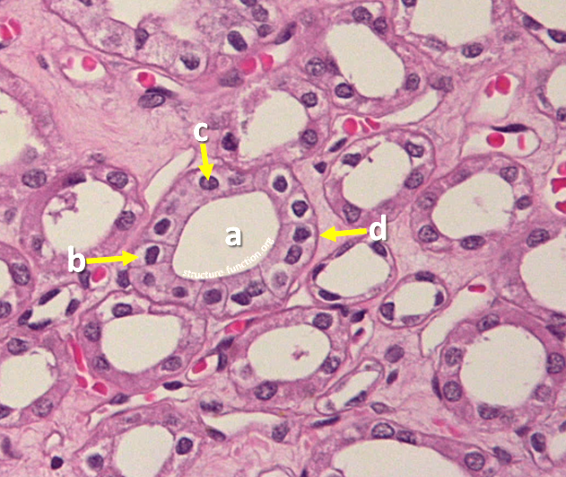 Picture of a tissue sample with arrows pointing to a ring of structures surrounding an open space indicated by the letter 'a'