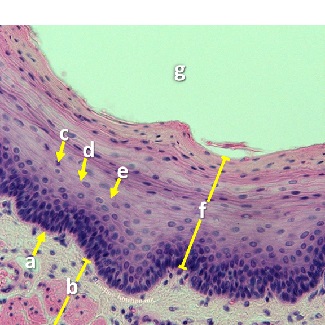 Thumbnail image of epithelial tissue, click to follow link and learn more about this tissue type