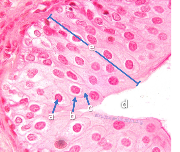 Picture of a tissue sample with arrows pointing to a ring of structures surrounding an open space indicated by the letter 'a'