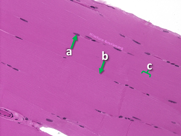 Picture of a tissue sample with arrows pointing to one of many nuclei along the cell membrane of an extremely long cell that has alternating dark and light bands