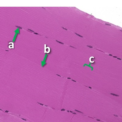 Thumbnail image of muscle tissue, click to follow link and learn more about this tissue type