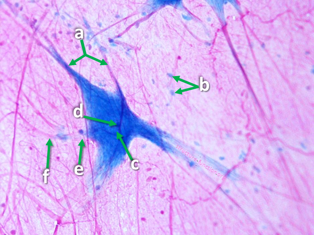 Picture of a tissue sample with arrows pointing to structures of a highly-branched cell