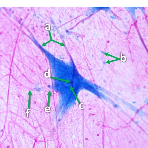 Thumbnail image of nervous tissue, click to follow link and learn more about this tissue type