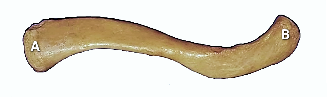 Picture of an S-shaped bone with arrows pointing to various features