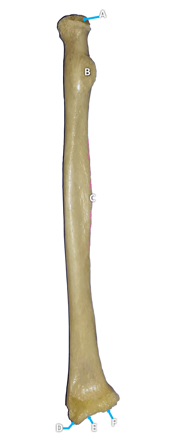 Picture of a long bone with one end like a monkey-wrench and arrows pointing to various features