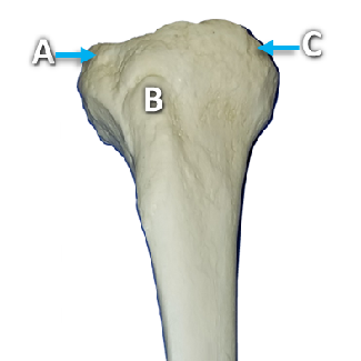 Anterior view of a tibia bone with structures labeled by letters