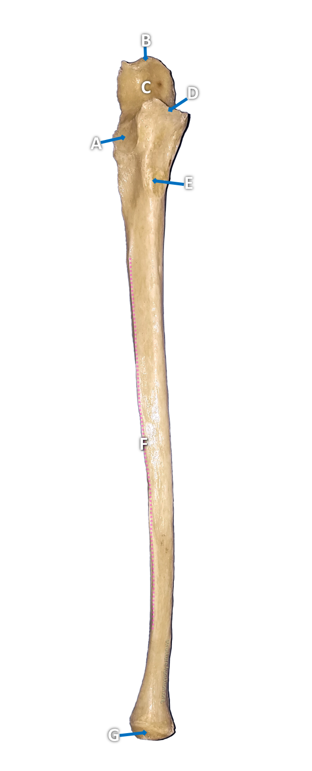 Picture of a long bone with one end like a monkey-wrench and arrows pointing to various features