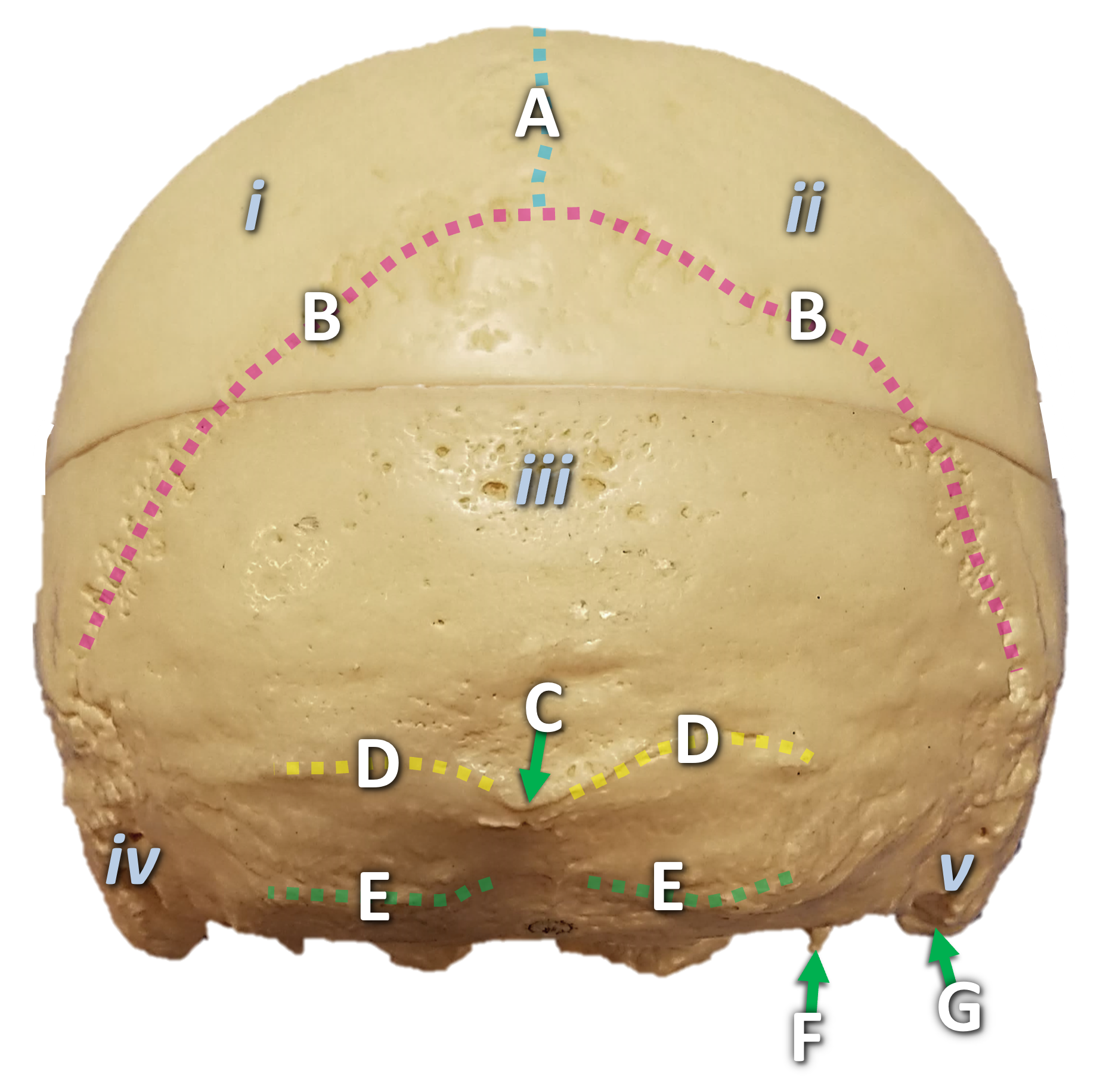 Picture of the posterior view of the skull with arrows pointing to various features